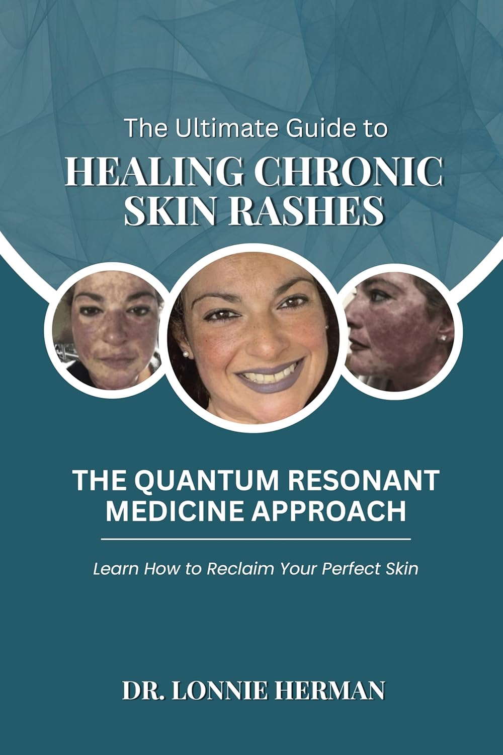 The Ultimate Guide To Healing Chronic Skin Rashes: The Quantum Resonant Medicine Approach